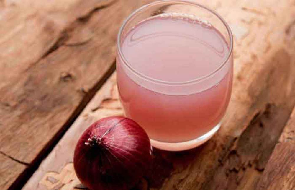 عوارض آب پیاز برای مو