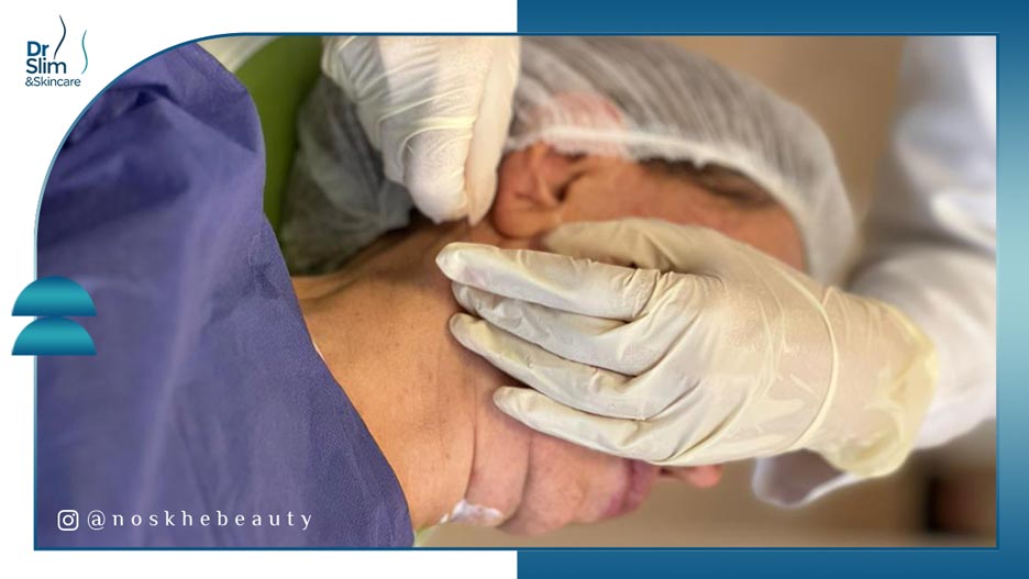 خداحافظی با شلی و چروک پوست اندولیفت و بوتاکس کدام بهتر است