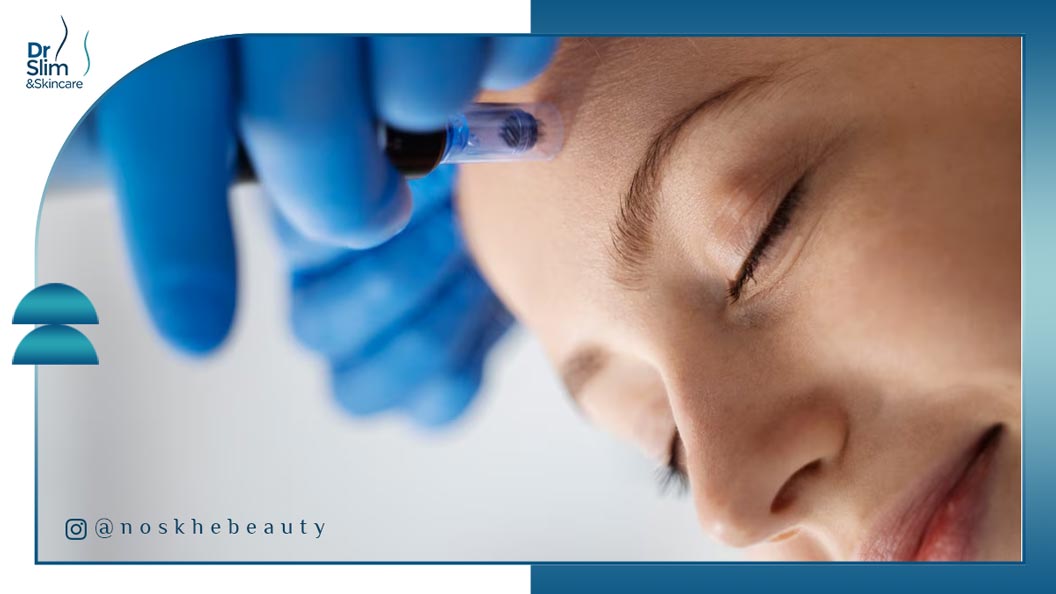 کلاژن‌ سازی با میکرونیدلینگ