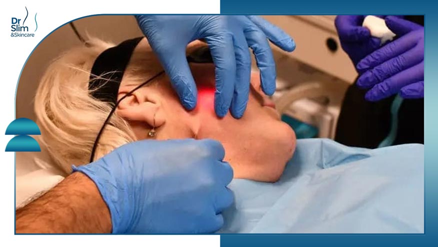 اندولیفت بهتر است یا پروفایلو