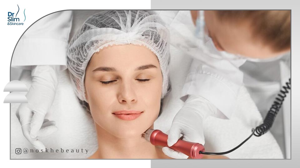 دستگاه آر اف فرکشنال