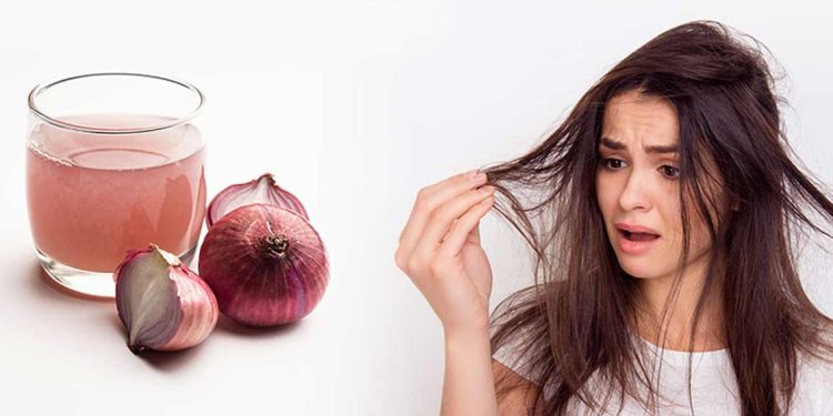 عوارض آب پیاز برای مو