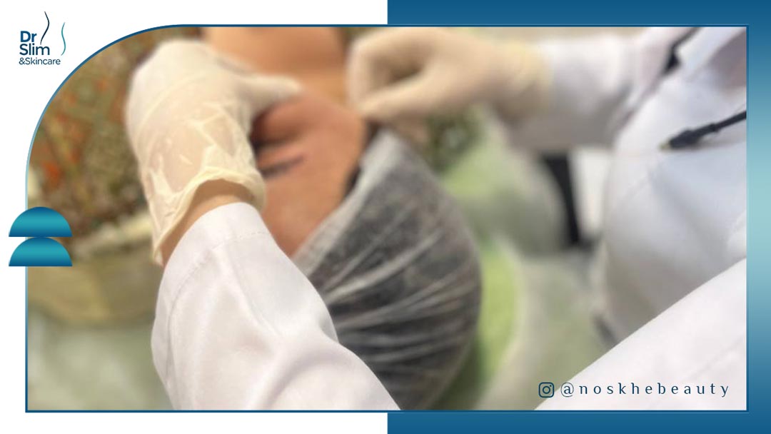 خداحافظی با شلی و چروک پوست اندولیفت و بوتاکس کدام بهتر است