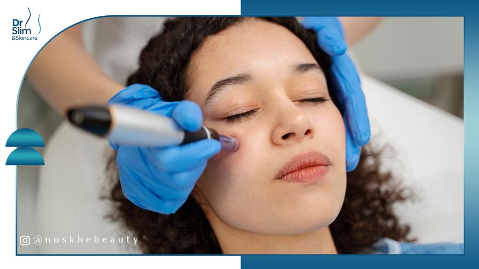 کلاژن‌ سازی با میکرونیدلینگ