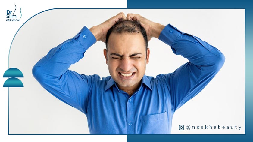 دلایل مهم ریزش مو و خارش سر انگل دمودکس را جدی بگیرید