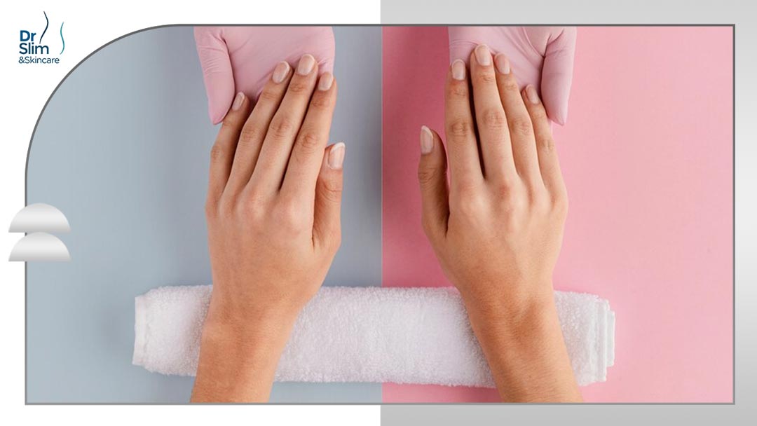 جوانسازی دست