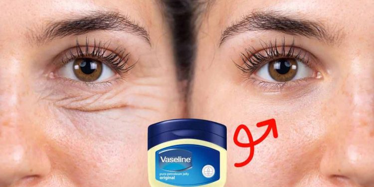 ایا وازلین چین و چروک را از بین می‌برد