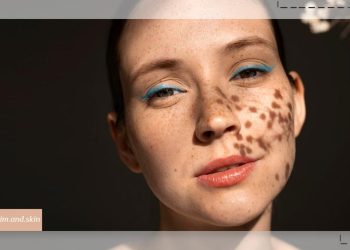 سریع ‌ترین راه برای از بین بردن لک صورت