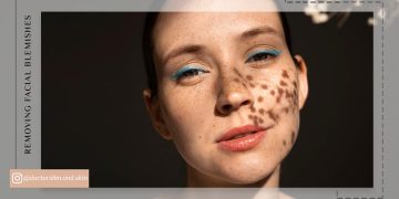 سریع ‌ترین راه برای از بین بردن لک صورت