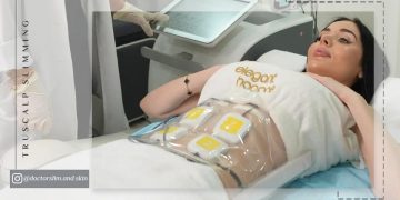 ترواسکالپ روش غیرتهاجمی لاغری و کانتورینگ بدن