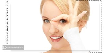 برطرف کردن گودی زیر چشم