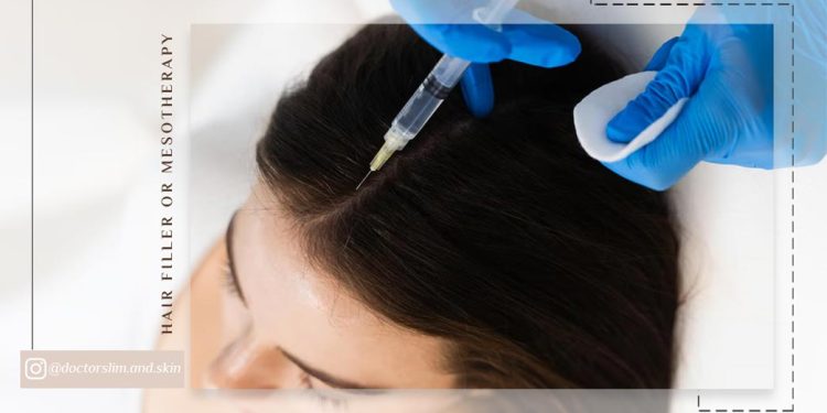 فیلر مو یا مزوتراپی