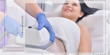 لاغری با کرایولیپولیز در تهران فقط یک جلسه