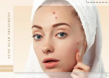 درمان اسکار جوش