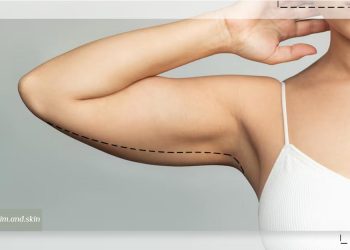 لاغری موضعی بازو