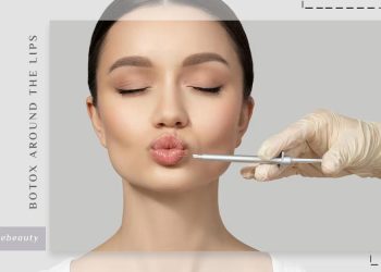 بوتاکس دور لب