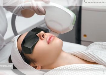 از بین بردن لکه ‌های قهوه ‌ای صورت با لیزر