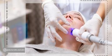 رفع غبغب با دستگاه آر اف بهترین و مؤثرترین روش