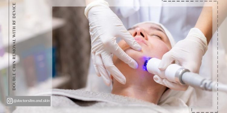 رفع غبغب با دستگاه آر اف بهترین و مؤثرترین روش