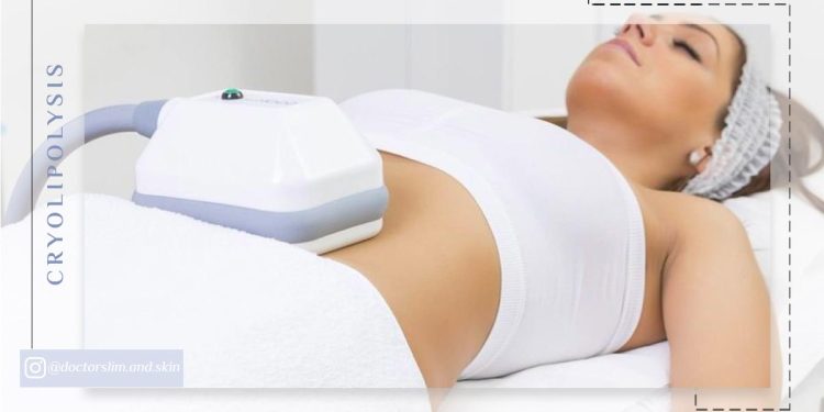 جوابدهی کرایولیپولیز