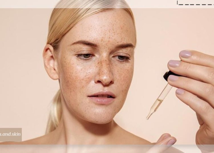 بهترین روغن برای لک قهوه‌ ای صورت