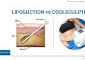 کول اسکالپتینگ و لیپوساکشن