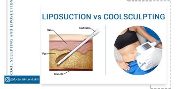 کول اسکالپتینگ و لیپوساکشن