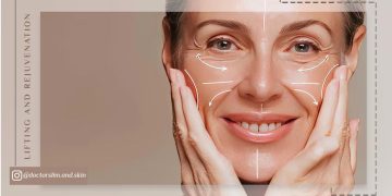 لیفتینگ و جوانسازی