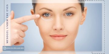 مزو ژل زیر چشم چیست