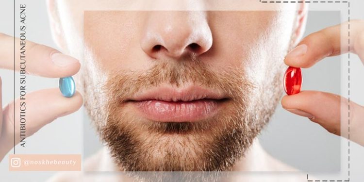 آنتی بیوتیک برای جوش زیر پوستی