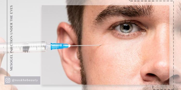 تزریق مزوژل به جای فیلر برای زیر چشم