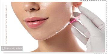 از بین بردن غبغب با نخ