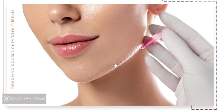 از بین بردن غبغب با نخ