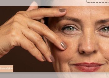 چین و چروک زیر چشم