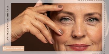 چین و چروک زیر چشم