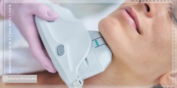 از بین بردن غبغب با لیزر