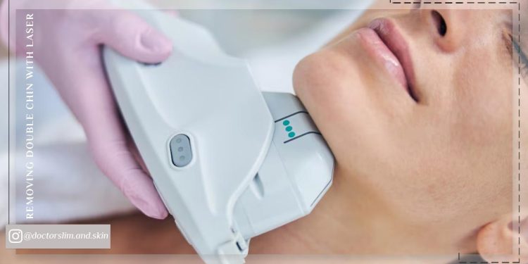 از بین بردن غبغب با لیزر