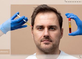 تفاوت پی آر پی و بایو فیلر