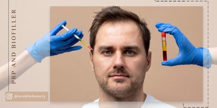 تفاوت پی آر پی و بایو فیلر