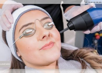 لیزر اربیوم یاگ برای درمان لک صورت