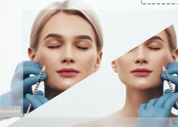 فیلر بهتر است یا بوتاکس