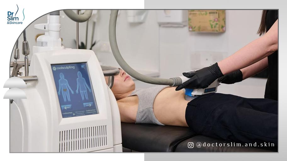 حذف چربی های اضافی زیر پوست با کول اسکالپتینگ