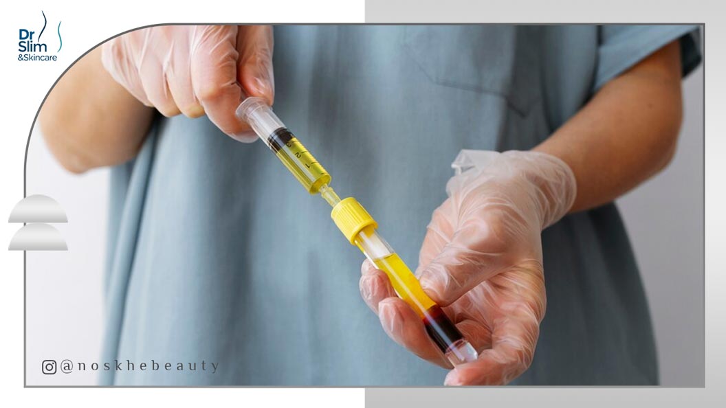 پی آر اف چیست