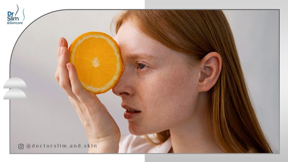 کمبود کدام ویتامین ‌ها باعث لک صورت می ‌شود