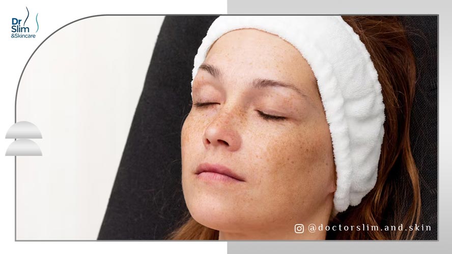 سریع ‌ترین راه برای از بین بردن لک صورت