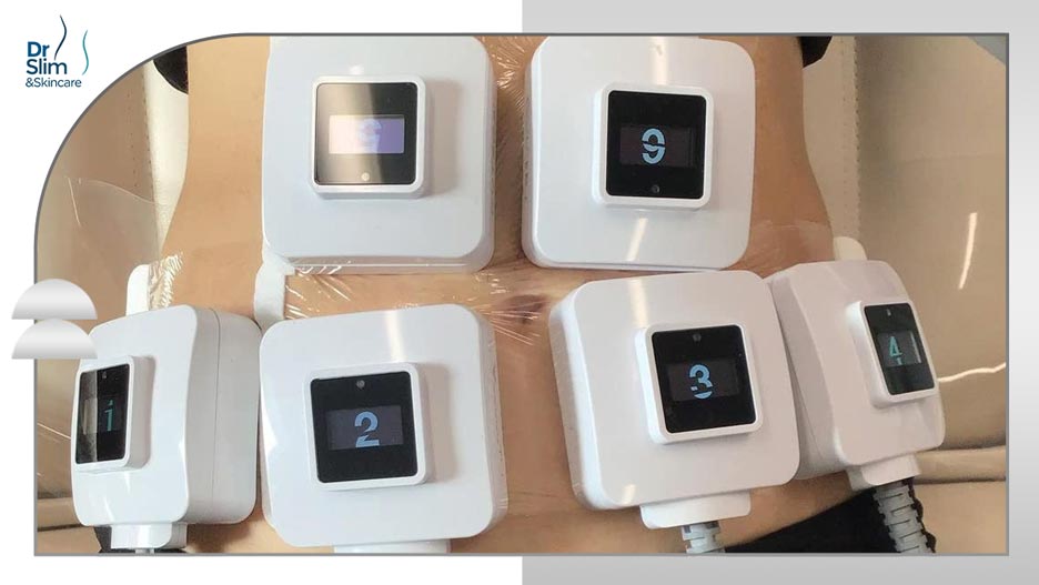 کول اسکالپتینگ چیست