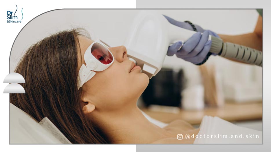 از بین بردن لکه های قهوه ای صورت با لیزر