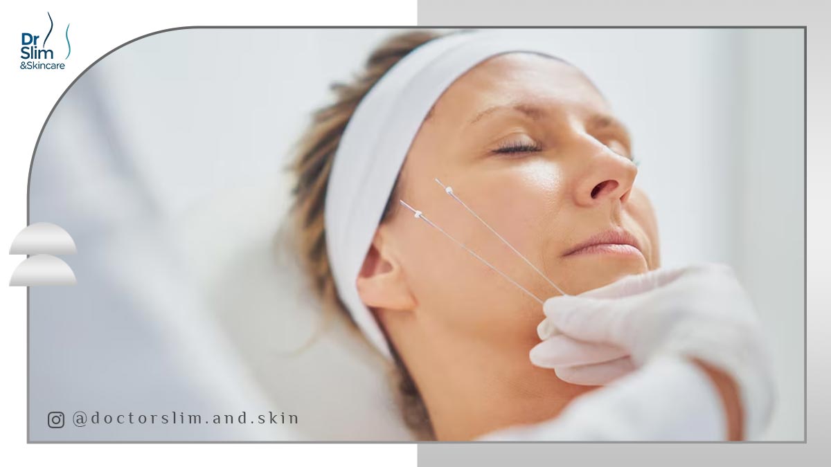 بهترین نخ لیفت صورت