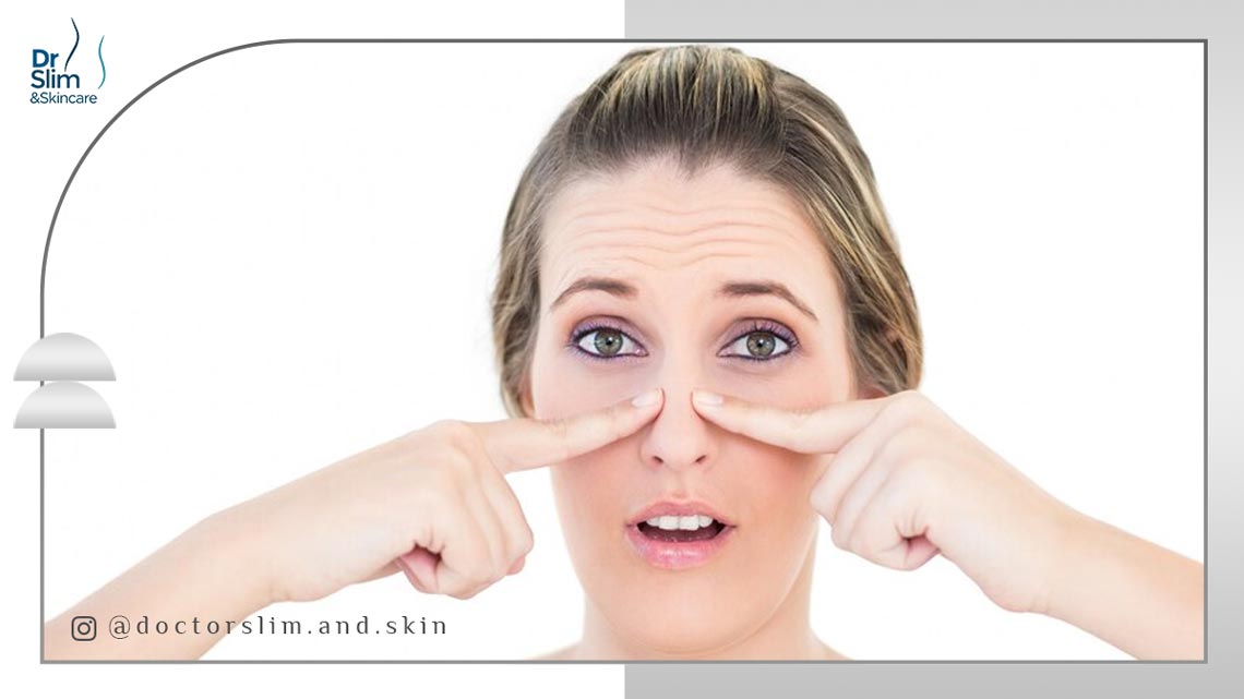 از بین بردن پف زیر چشم