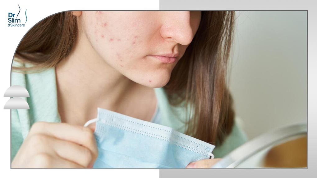 آنتی بیوتیک برای جوش زیر پوستی